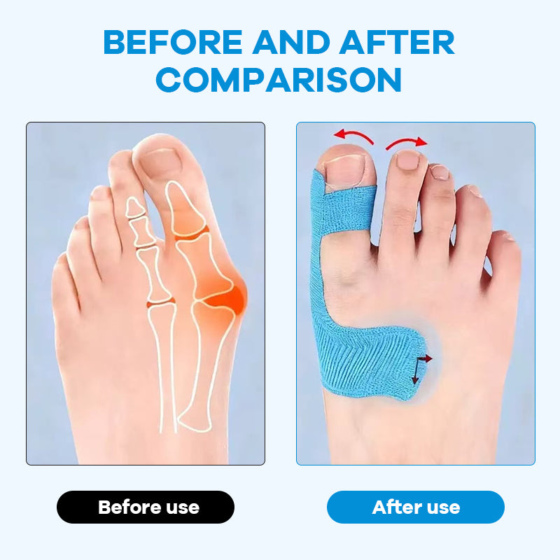 👠Pre-cut Bunion Corrector Kinesiology Tape