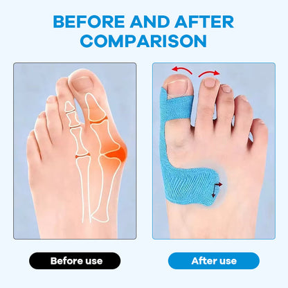👠Pre-cut Bunion Corrector Kinesiology Tape