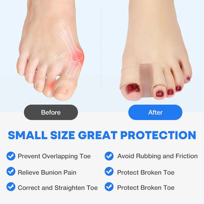 Toe Separator & Bunion Corrector 🦶