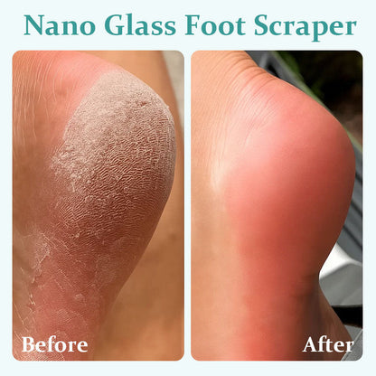 💜Nano Glass Foot Scraper For Exfoliating Dead Skin