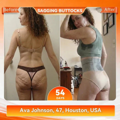 4-in-1 Shaping and Fat-Burning Microfiber Shorts